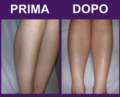 gambe