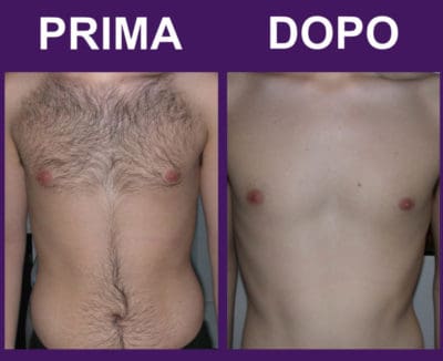 petto