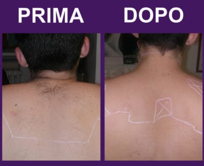 spalle