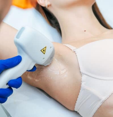 laser-epilazione-a-diodo laser-epilazione-a-diodo